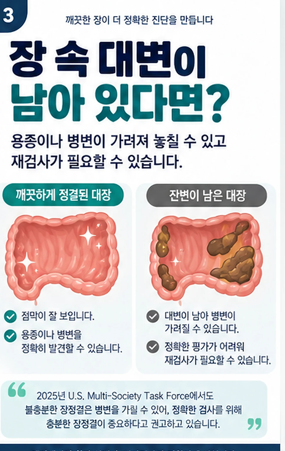장정결 실패 경험이 있으면 대구 대장내시경 준비를 어떻게 달리하나요? 2